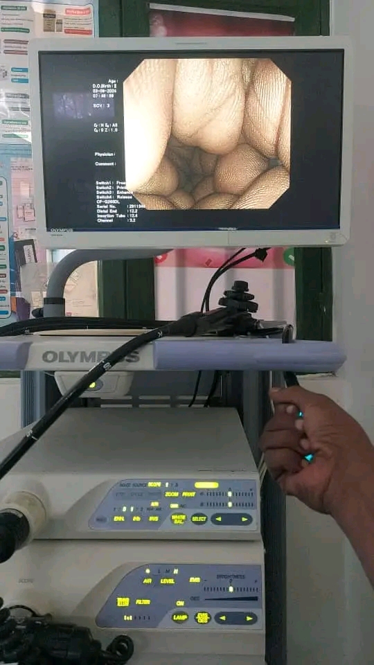 olympus 260 endoscopy photo 3