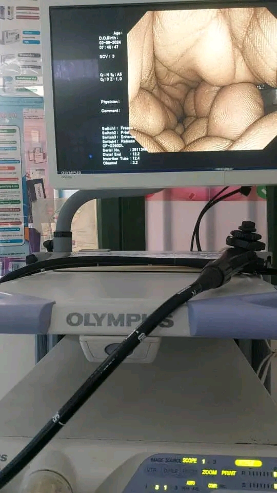 olympus 260 endoscopy photo 4