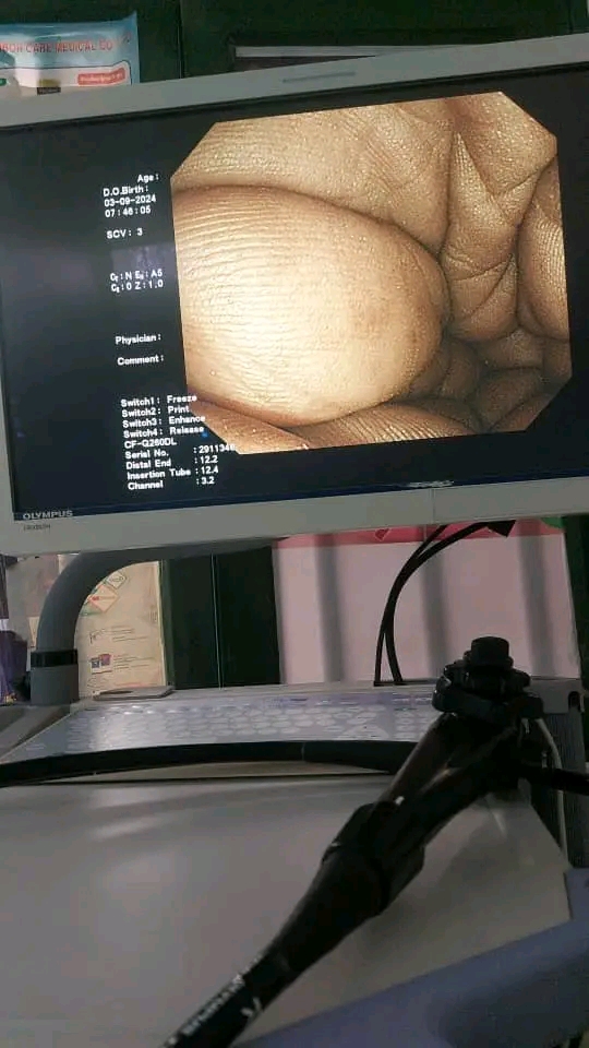 olympus 260 endoscopy photo 5